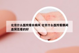 北京什么医院看白癜风 北京什么医院看腰间盘突出看的好