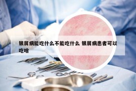 银屑病能吃什么不能吃什么 银屑病患者可以吃啥