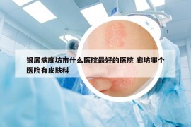 银屑病廊坊市什么医院最好的医院 廊坊哪个医院有皮肤科