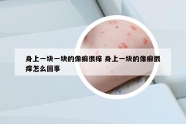 身上一块一块的像癣很痒 身上一块的像癣很痒怎么回事