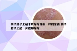 孩子脖子上起干皮痒痒像癣一样的东西 孩子脖子上起一片疙瘩痒痒