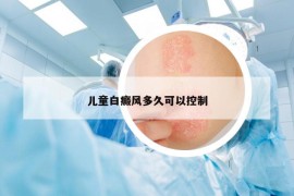 儿童白癜风多久可以控制