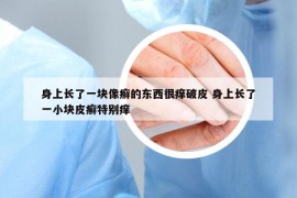 身上长了一块像癣的东西很痒破皮 身上长了一小块皮癣特别痒