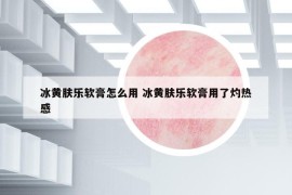 冰黄肤乐软膏怎么用 冰黄肤乐软膏用了灼热感