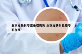 北京皮肤科专家免费咨询 北京皮肤科免费专家在线