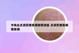 中央台点滴型银屑病视频讲座 点滴型银屑病银屑病