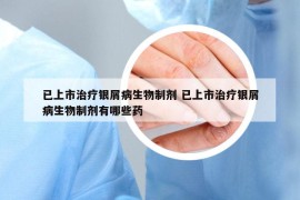 已上市治疗银屑病生物制剂 已上市治疗银屑病生物制剂有哪些药