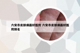 六安市皮肤病最好医院 六安市皮肤病最好医院排名