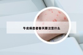 牛皮癣患者春天要注意什么