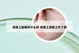 皮肤上起癣长什么样 皮肤上皮肤上长了癣