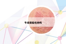 牛皮藓能吃肉吗