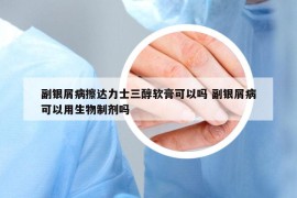 副银屑病擦达力士三醇软膏可以吗 副银屑病可以用生物制剂吗