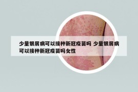 少量银屑病可以接种新冠疫苗吗 少量银屑病可以接种新冠疫苗吗女性