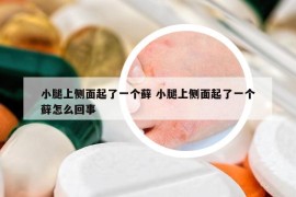 小腿上侧面起了一个藓 小腿上侧面起了一个藓怎么回事