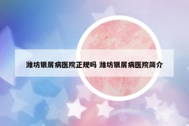 潍坊银屑病医院正规吗 潍坊银屑病医院简介