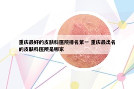 重庆最好的皮肤科医院排名第一 重庆最出名的皮肤科医院是哪家
