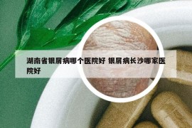 湖南省银屑病哪个医院好 银屑病长沙哪家医院好