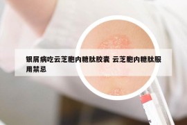 银屑病吃云芝胞内糖肽胶囊 云芝胞内糖肽服用禁忌