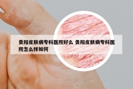 贵阳皮肤病专科医院好么 贵阳皮肤病专科医院怎么样如何