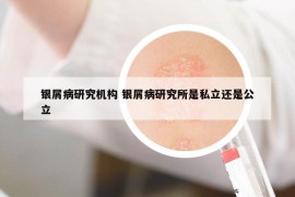 银屑病研究机构 银屑病研究所是私立还是公立