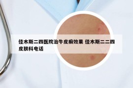 佳木斯二四医院治牛皮癣效果 佳木斯二二四皮肤科电话