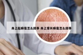 身上起癣是怎么回事 身上爱长癣是怎么回事