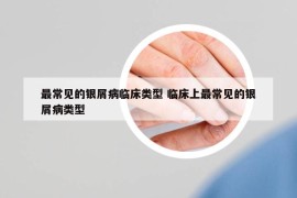 最常见的银屑病临床类型 临床上最常见的银屑病类型