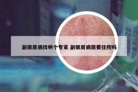 副银屑病找啊个专家 副银屑病需要住院吗