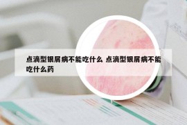 点滴型银屑病不能吃什么 点滴型银屑病不能吃什么药