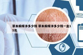 草本癣痒净多少钱 草本癣痒净多少钱一盒15克