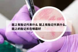 腿上有胎记代表什么 腿上有胎记代表什么,腿上的胎记长在哪最好