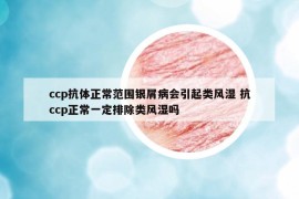 ccp抗体正常范围银屑病会引起类风湿 抗ccp正常一定排除类风湿吗