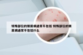 特殊部位的银屑病通常不包括 特殊部位的银屑病通常不包括什么