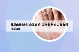 生物制剂会影响生育吗 生物制剂对生育有没有影响