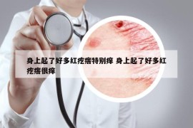 身上起了好多红疙瘩特别痒 身上起了好多红疙瘩很痒