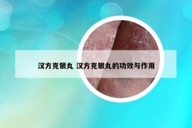 汉方克银丸 汉方克银丸的功效与作用