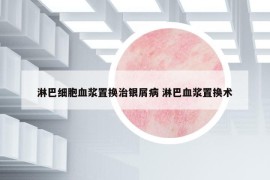 淋巴细胞血浆置换治银屑病 淋巴血浆置换术