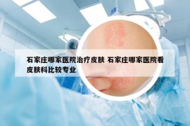 石家庄哪家医院治疗皮肤 石家庄哪家医院看皮肤科比较专业