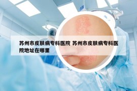 苏州市皮肤病专科医院 苏州市皮肤病专科医院地址在哪里