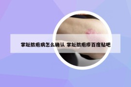 掌趾脓疱病怎么确认 掌趾脓疱疹百度贴吧