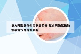 复方丙酸氯倍他索软膏价格 复方丙酸氯倍他索软膏作用是激素吗