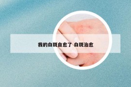 我的白斑自愈了 白斑治愈