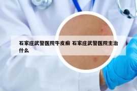 石家庄武警医院牛皮癣 石家庄武警医院主治什么