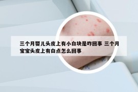 三个月婴儿头皮上有小白块是咋回事 三个月宝宝头皮上有白点怎么回事