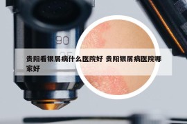 贵阳看银屑病什么医院好 贵阳银屑病医院哪家好