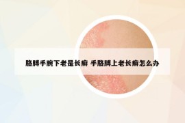 胳膊手腕下老是长癣 手胳膊上老长癣怎么办