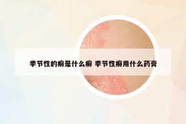 季节性的癣是什么癣 季节性癣用什么药膏