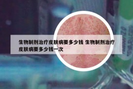 生物制剂治疗皮肤病要多少钱 生物制剂治疗皮肤病要多少钱一次