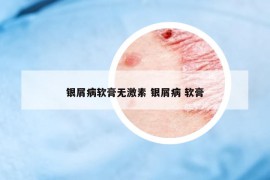 银屑病软膏无激素 银屑病 软膏