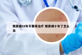 银屑病10年不要再治疗 银屑病十年了怎么治